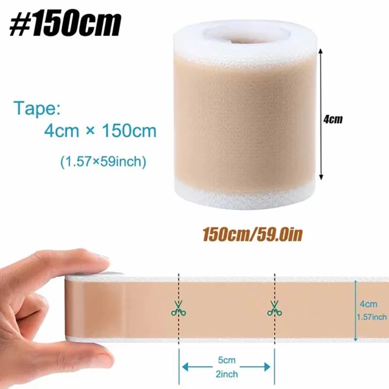 Medical Tape - 50/100/150cm シリコンゲル傷跡シートパッチ 治療除去テープ ニキビ外傷火傷傷跡カバー 肌修復 セクション耳美容
