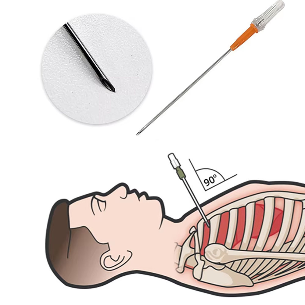 1セット：緊急用具、応急処置キット、気胸用穿刺針、胸部減圧用 - First Aid Kit のレビューと価格