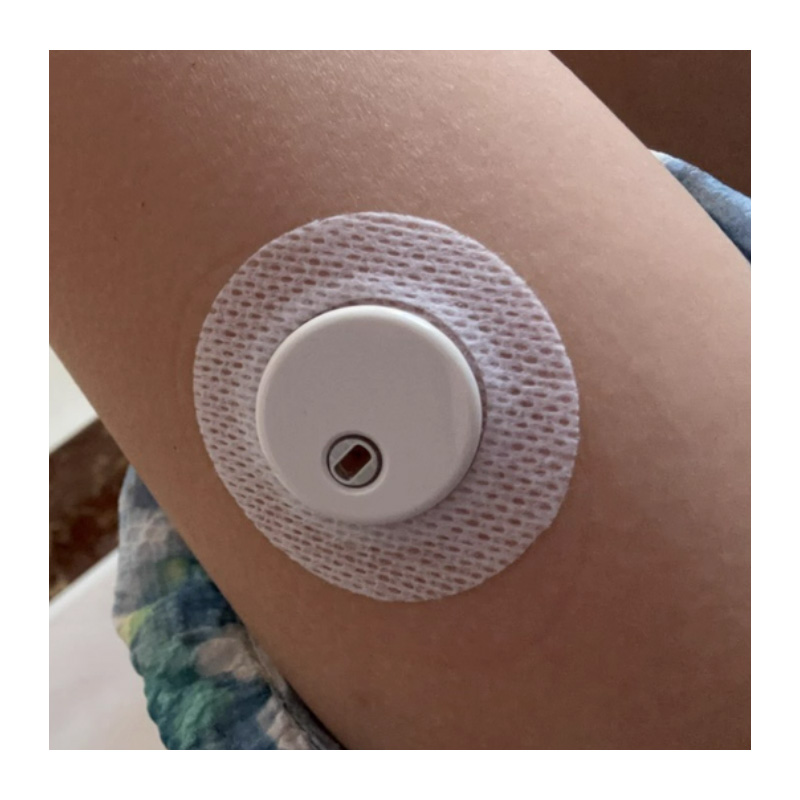 オリジナルLinxセンサーパッチCGMステッカー医療用粘着テ - Medical Tape のレビューと価格