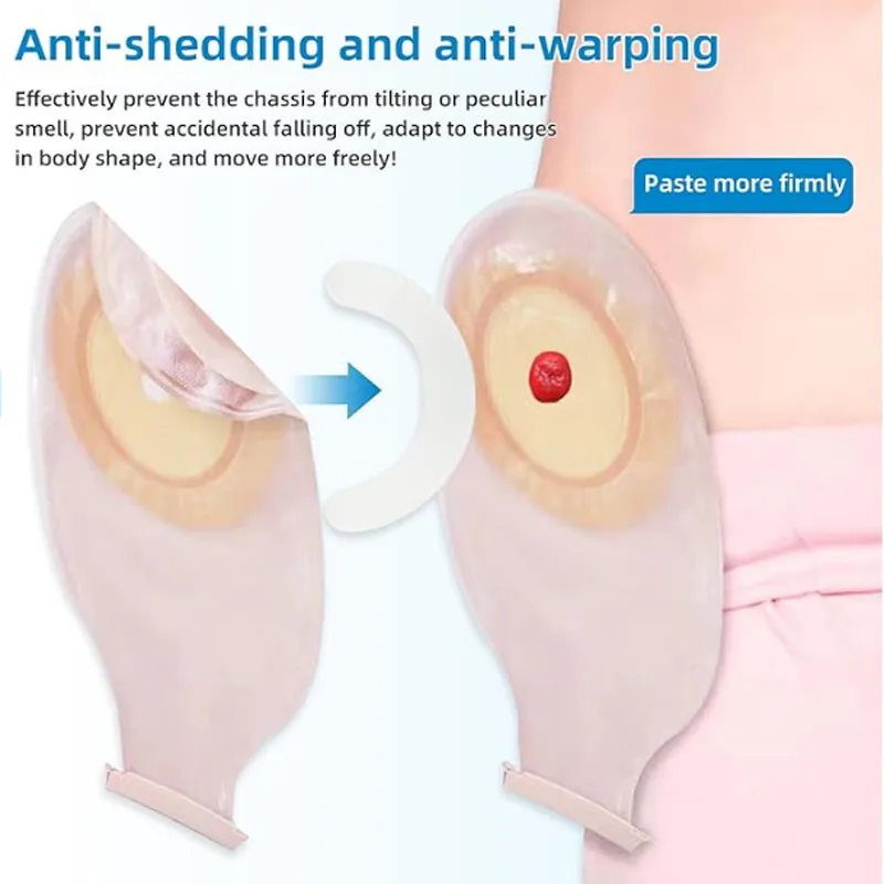 医療用オストミーバッグ補強ストリップ弾性感圧テープスパンレー - Medical Tape のレビューと価格